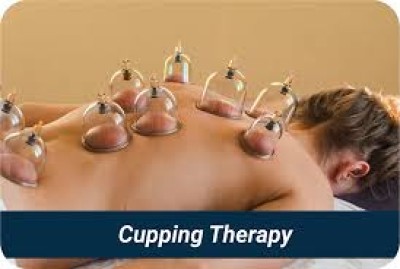 Cupping Therapy